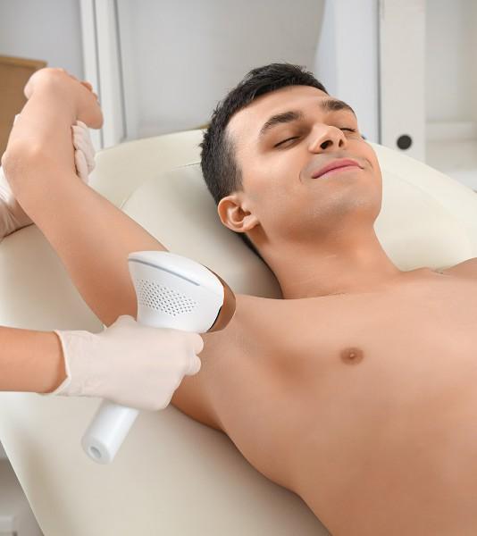 laser epilation definitive